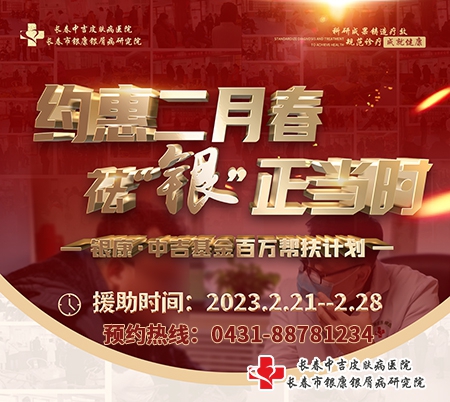 长春中吉牛皮癣医院2月春季牛皮癣治疗优惠活动 长春中吉牛皮癣医院2月春季牛皮癣治疗优惠活动