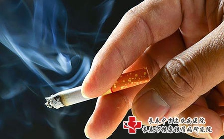 治疗护理牛皮癣怎么做？