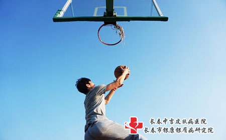 牛皮癣患者如何提高免疫力，改善免疫功能?