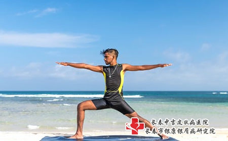 红皮型牛皮癣危害并发症 红皮型牛皮癣危害并发症