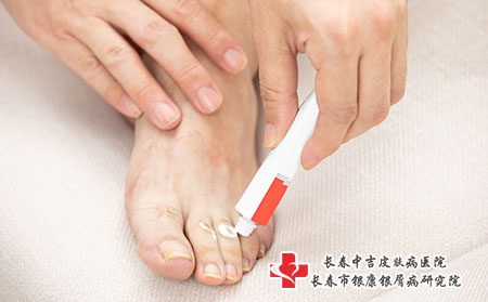 摄图网_501661624_脚部涂抹药膏（企业商用）