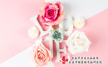 牛皮癣的病因