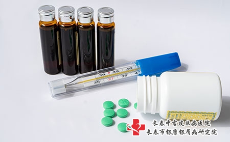 关节型牛皮癣怎么用药效果好