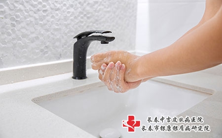 生活中正确护理，远离牛皮癣式毁容