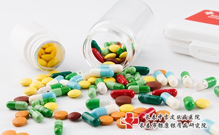 得了牛皮癣吃什么药比较好