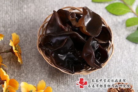 牛皮癣危害大，生活中该怎样护理呢