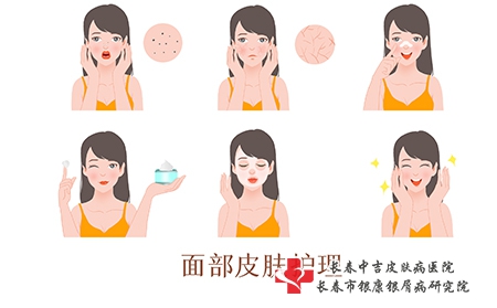 牛皮癣患者平时需要注意什么呢？
