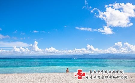 如何治疗牛皮癣？长春牛皮癣专家详解