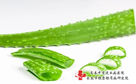 年轻人牛皮癣危害有哪些
