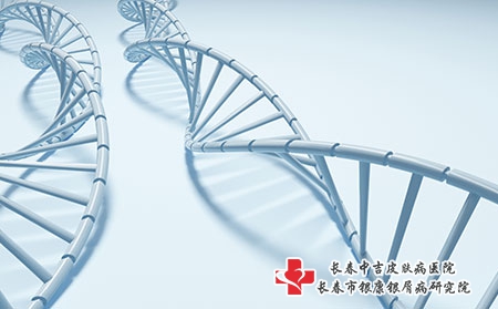 牛皮癣的中西医诊断