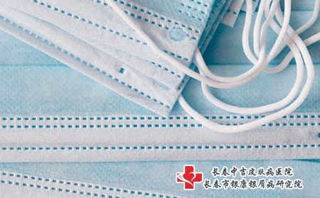 牛皮癣初期四个症状表现你知道吗