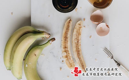 头上长了牛皮癣该怎么办?