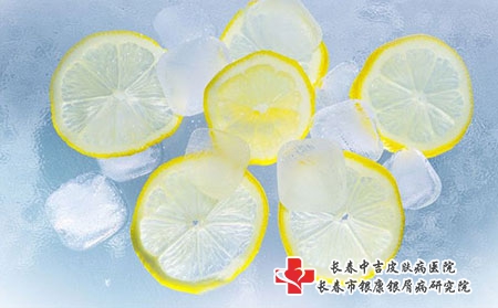 常规治疗牛皮癣的方法有什么