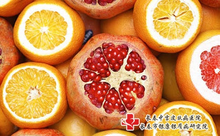 牛皮癣一直治不好，来试试中医中药法吧