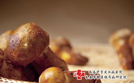 夏季到了，儿童牛皮癣该怎么治疗呢