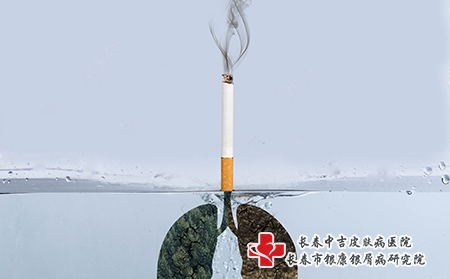 长春牛皮癣医院-世界无烟日烟草威胁环境，吸烟有害健康