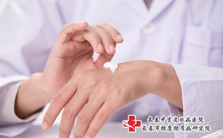 牛皮癣五大常见诱因是什么?