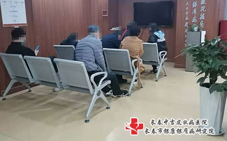 长春专业看牛皮癣-长春银屑病医院几点下班