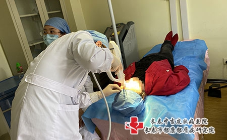 长春治疗银屑病的医院，这份实用指南收好