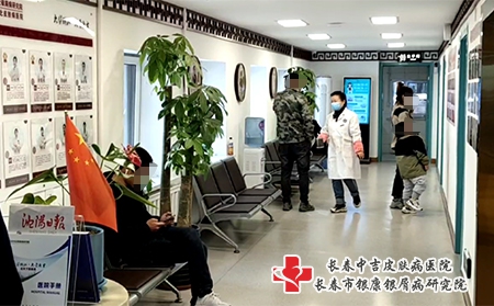 沈阳中医银屑病看-沈阳哪个医院看的好
