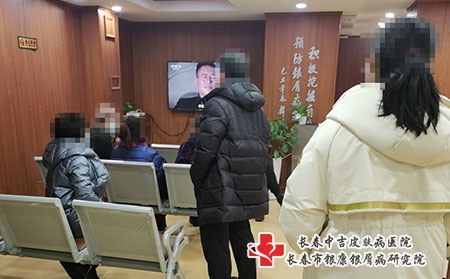 长春哪里治牛皮癣-长春银屑病医院治疗价位 长春哪里治牛皮癣-长春银屑病医院治疗价位