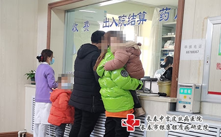 长春银屑病哪能治-长春治银屑病哪里好 长春银屑病哪能治-长春治银屑病哪里好
