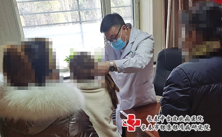长春牛皮癣的医院-长春去哪治银屑病医院好