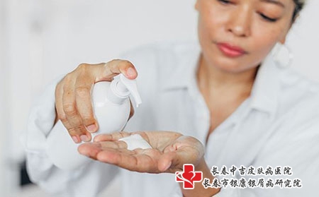 长春治疗银屑病医院医生 夏季对银屑病的影响如何护理好