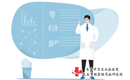 长春治疗银屑病哪家好-长春治疗银屑病的专科医院