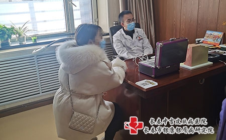 长春看好的银屑病医院-长春哪里看银屑病最好