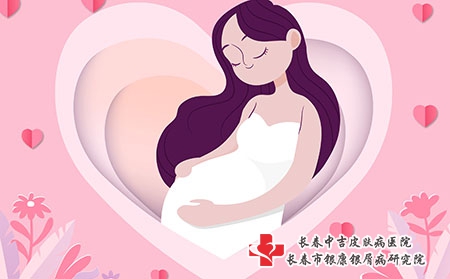 怀孕期间患上牛皮癣该怎么办?
