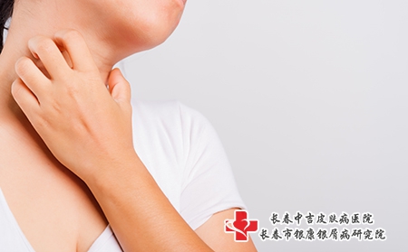 摄图网_307247341_瘙痒皮肤(企业商用) 摄图网_307247341_瘙痒皮肤(企业商用)