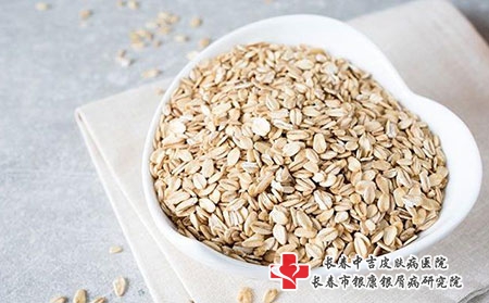 2 (82)饮食
