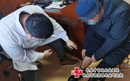 长春怎样除牛皮癣-长春银屑病医院疗效如何