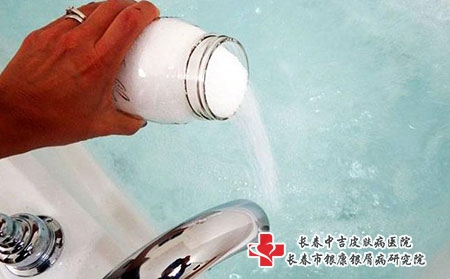 牛皮癣患者用盐洗澡可以吗