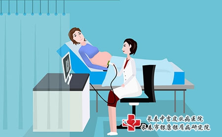 孕妇有银屑病会遗传给孩子