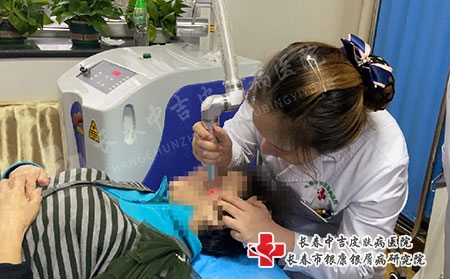 长春牛皮癣能治吗-长春哪家看银屑病比较好