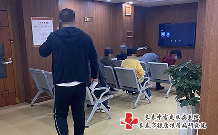 长春市好治牛皮癣-长春治疗银屑病费用多少
