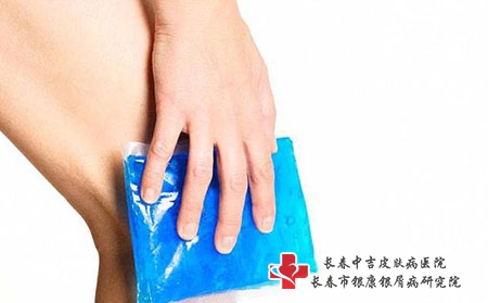 长春银屑病医院-银屑病和类风湿关节炎有什么区别