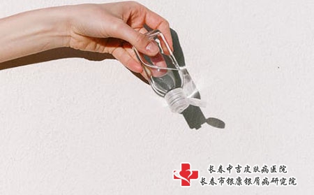 代谢障碍是否会引起银屑病呢?