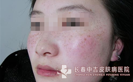 治疗方法