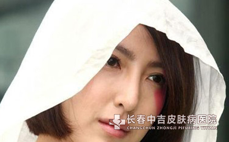 治疗方法