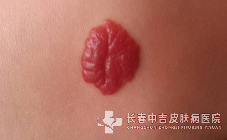 治疗方法