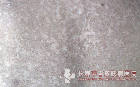 严重程度分类