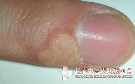 治疗方法