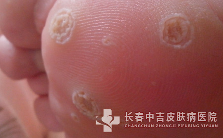 鉴别诊断