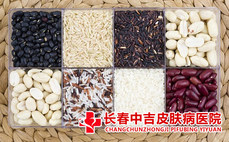 痤疮应该如何正确饮食