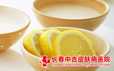  祛斑去除的方法有哪些