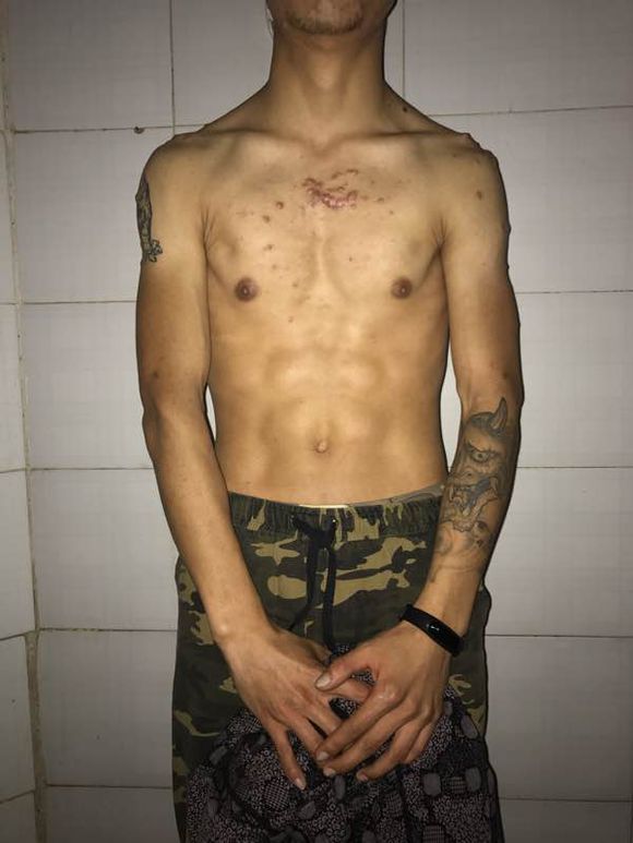 长出瘢痕