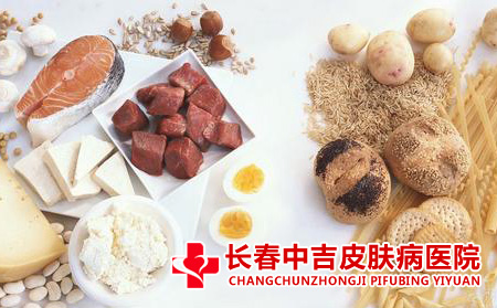 科学膳食对白癜风的合适处